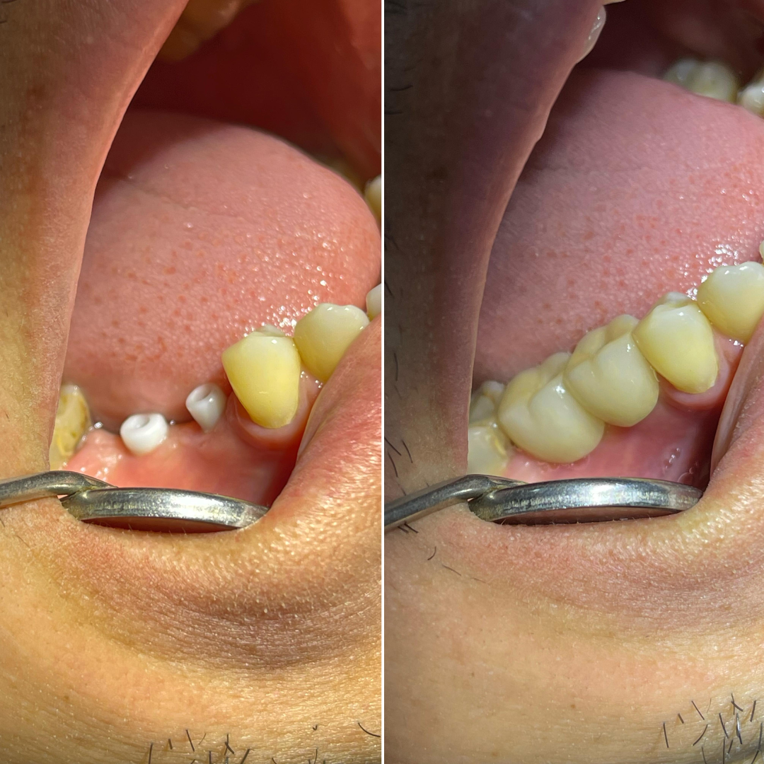 dentista-vila-velha-es